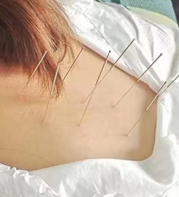 女子针灸_副本.png