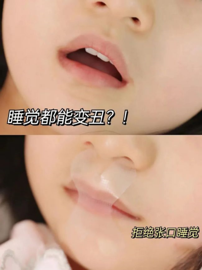 张口贴真的有用吗_副本.png