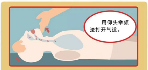 开放气道手法_副本.png